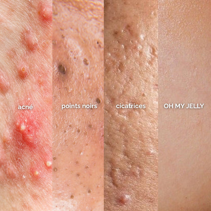 FRAISE 🍓 - MASQUE JELLY PEAU GRASSE