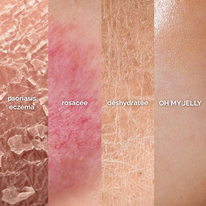 CONCOMBRE 🥒 - MASQUE JELLY PEAU SÈCHE