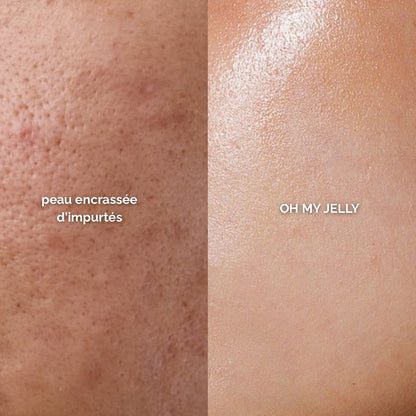 CHARBON DE COCO 🥥 - MASQUE JELLY DETOX